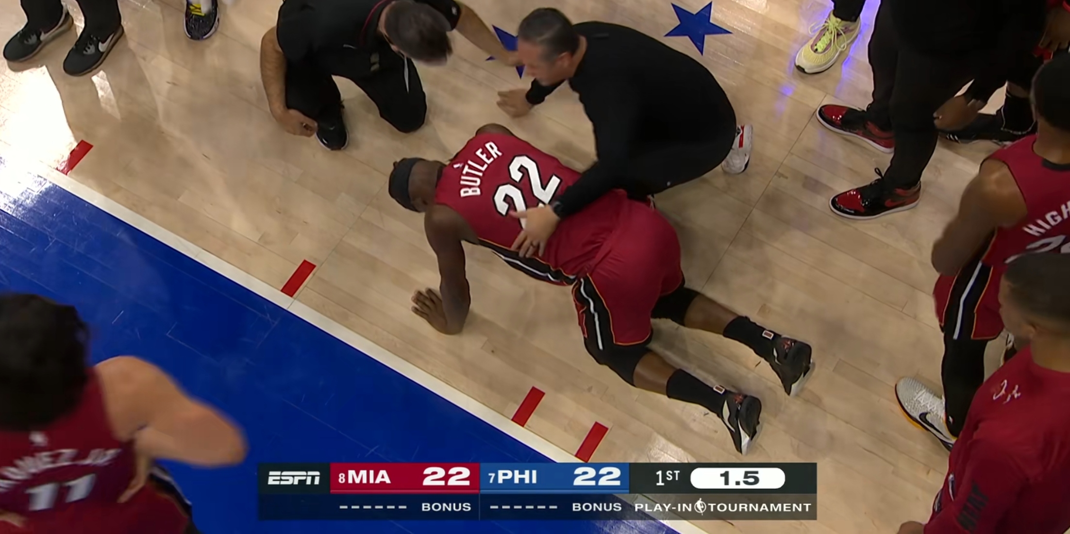 人队医团队全面检查恩比德膝伤，或需手术治疗的简单介绍